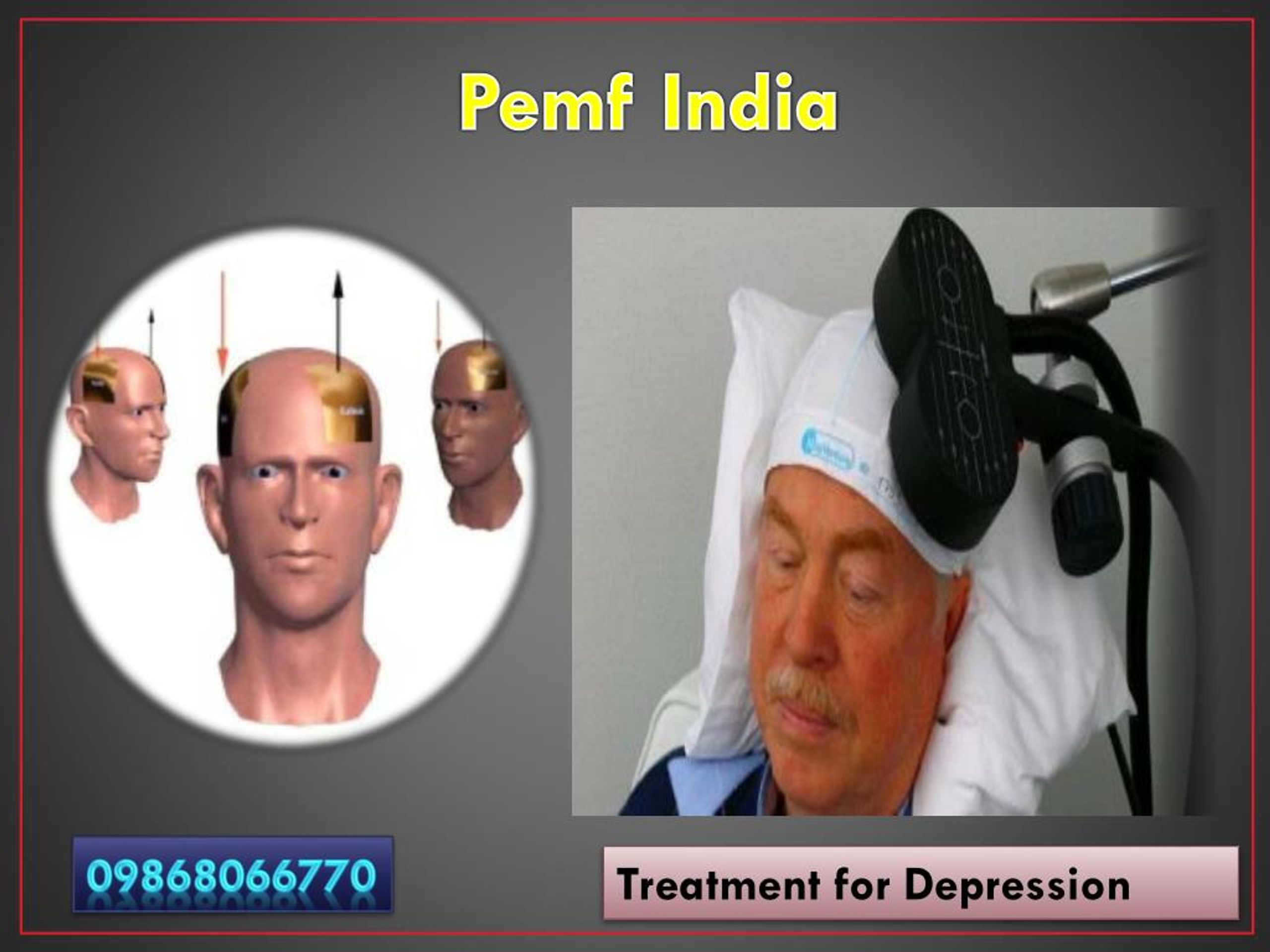 PPT Therapy & Treatment for Body, Depression, Neurological