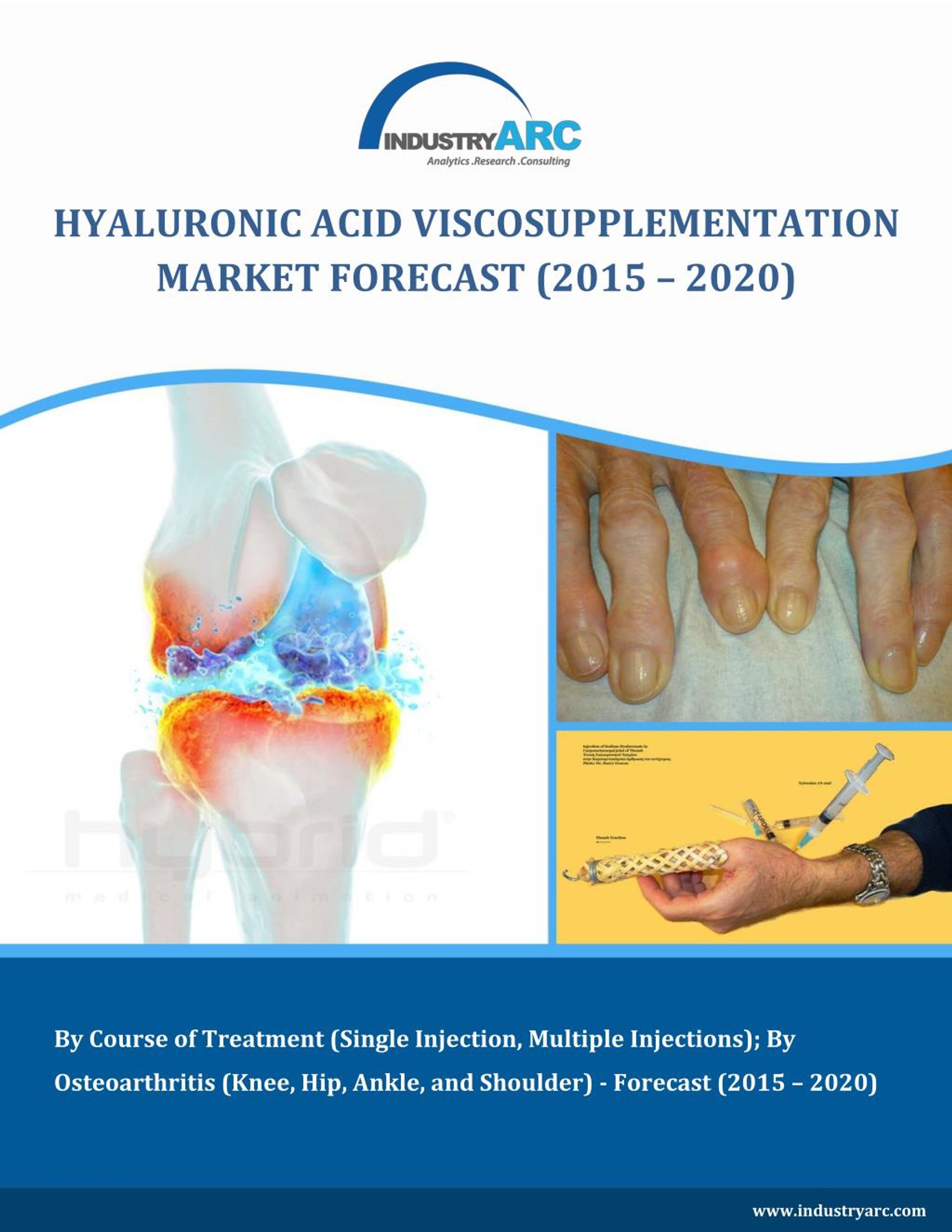 PPT Hyaluronic Acid Viscosupplementation Market PowerPoint