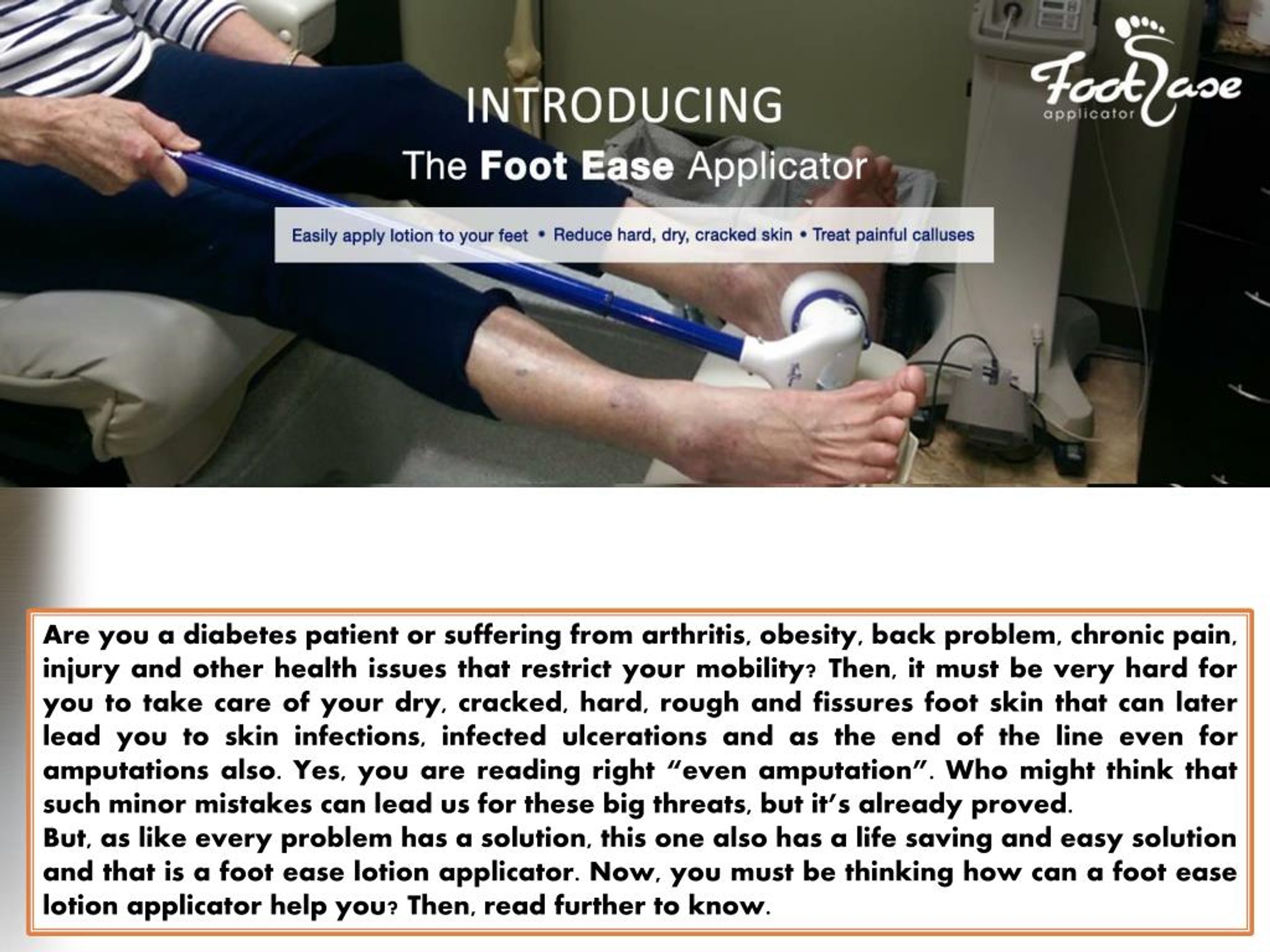 PPT Why to Use a Foot Ease Lotion Applicator PowerPoint Presentation