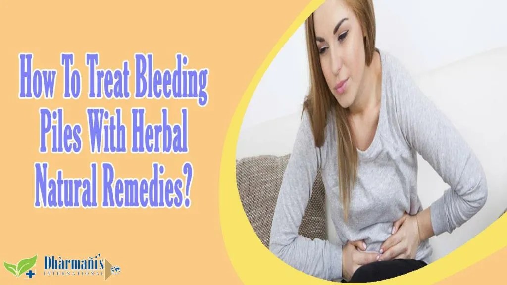 PPT How To Treat Bleeding Piles With Herbal Natural Remedies