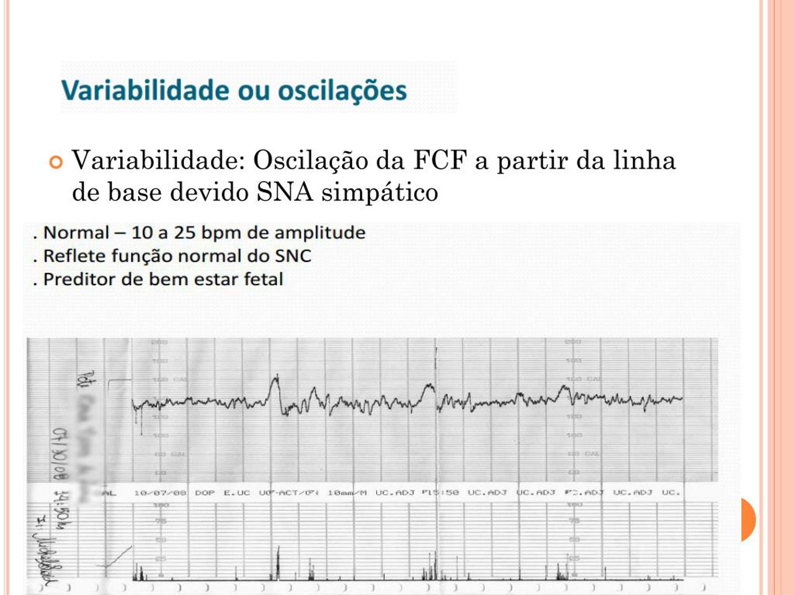 PPT CTB e Vitalidade Fetal PowerPoint Presentation, free download