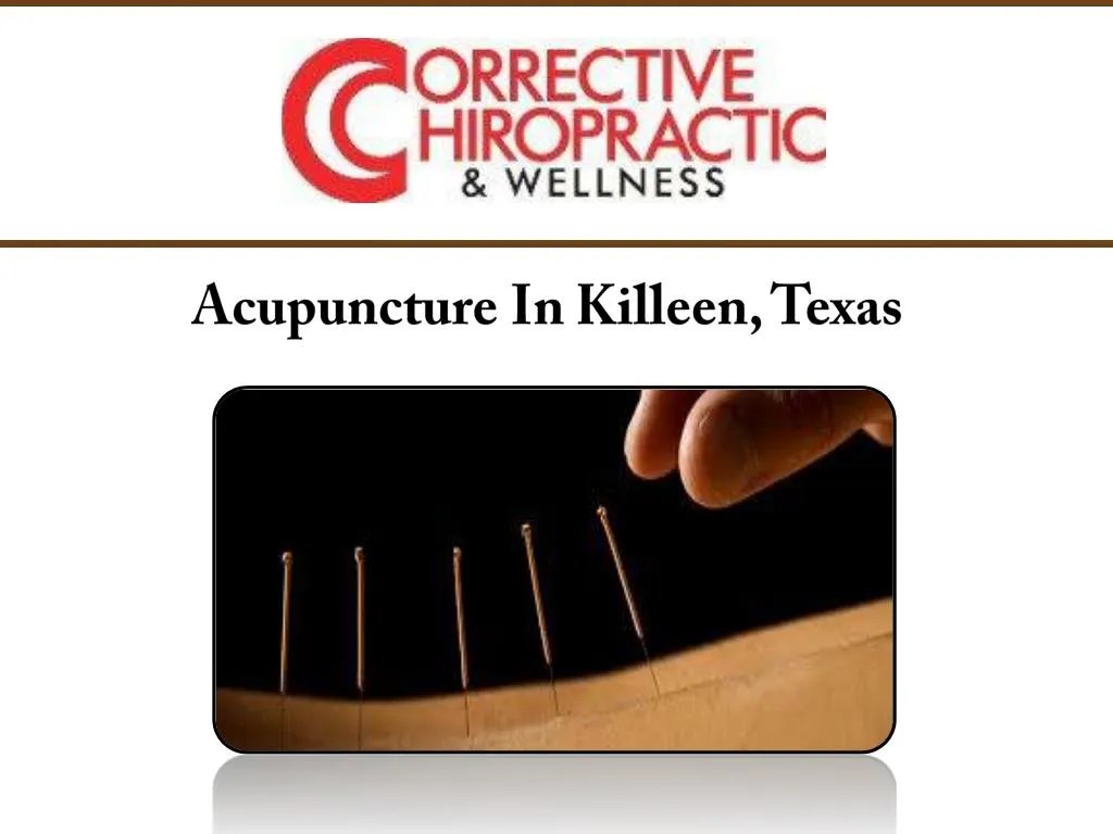 PPT Acupuncture In Killeen, Texas PowerPoint Presentation, free