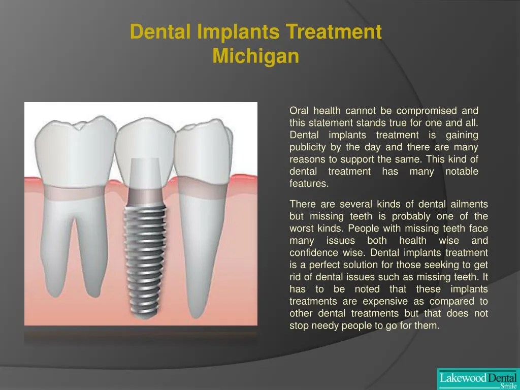 PPT Dental implant specialist Michigan PowerPoint Presentation, free