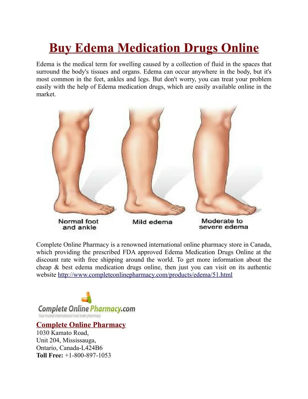 PPT Buy Edema Medication Drugs Online PowerPoint Presentation, free