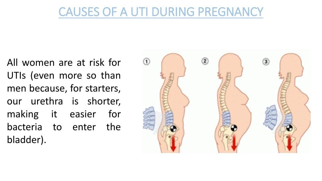 List Of Symptoms Urine Infection When Pregnant 2022
