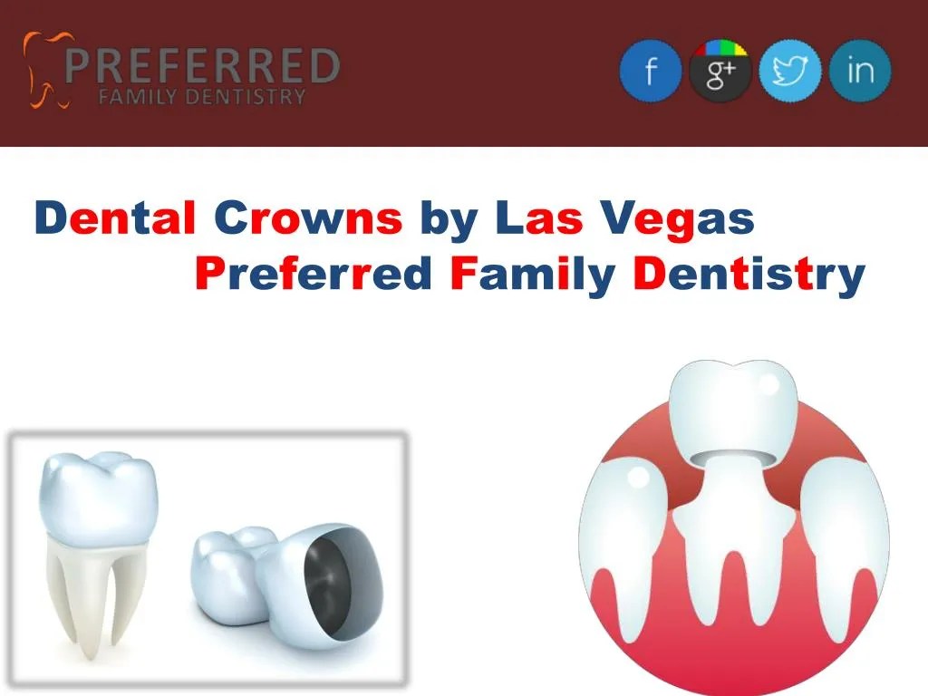 PPT Dental Crowns by Las Vegas Preferred Family Dentistry PowerPoint Presentation ID7299195