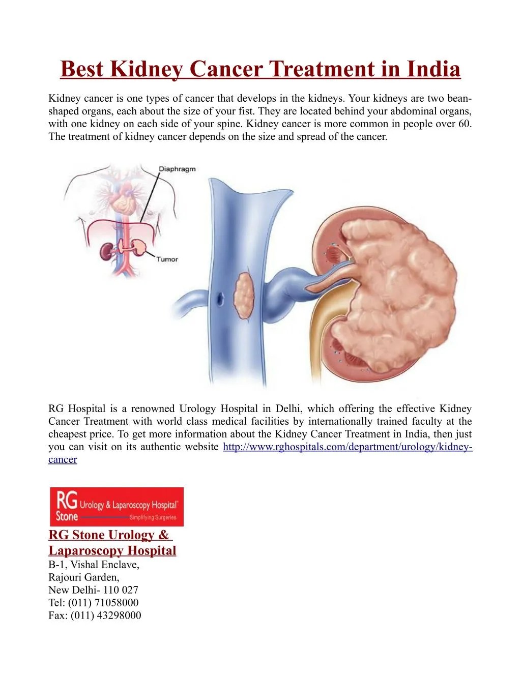 PPT Best Kidney Cancer Treatment in India PowerPoint Presentation