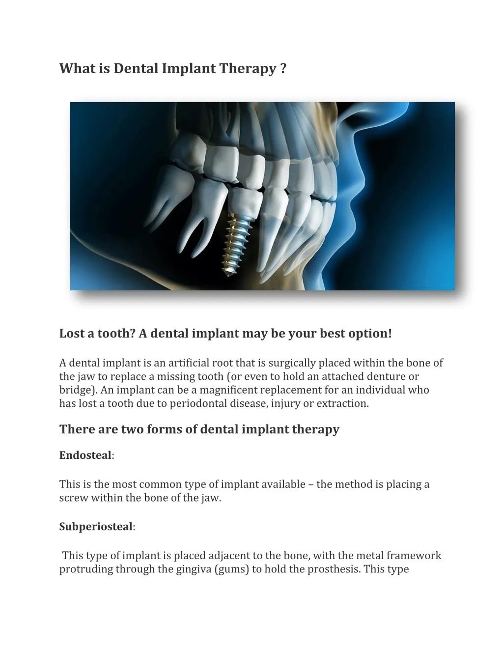 PPT What is Dental Implant Therapy ? PowerPoint Presentation, free