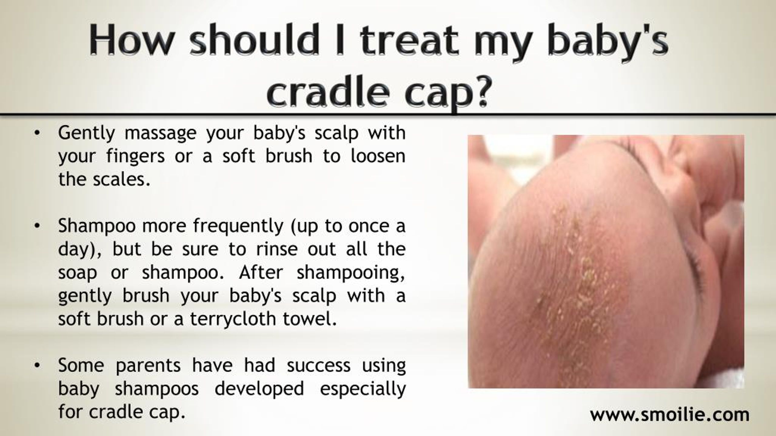 PPT Cradle Cap PowerPoint Presentation, free download ID7336452