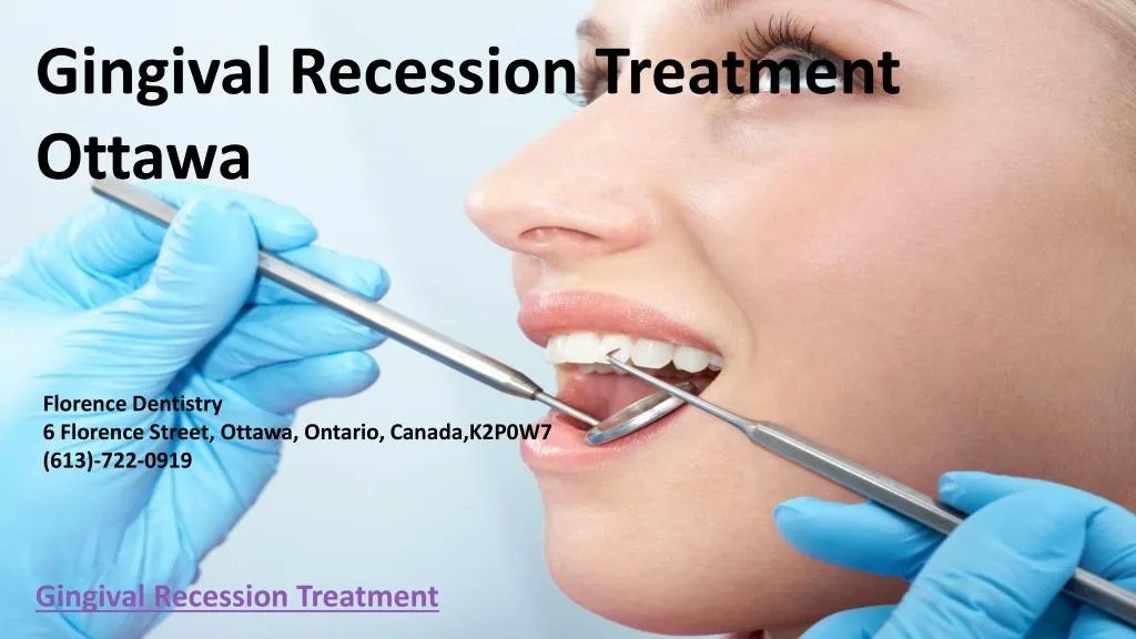 PPT Gingival Recession Treatment Ottawa PowerPoint Presentation, free