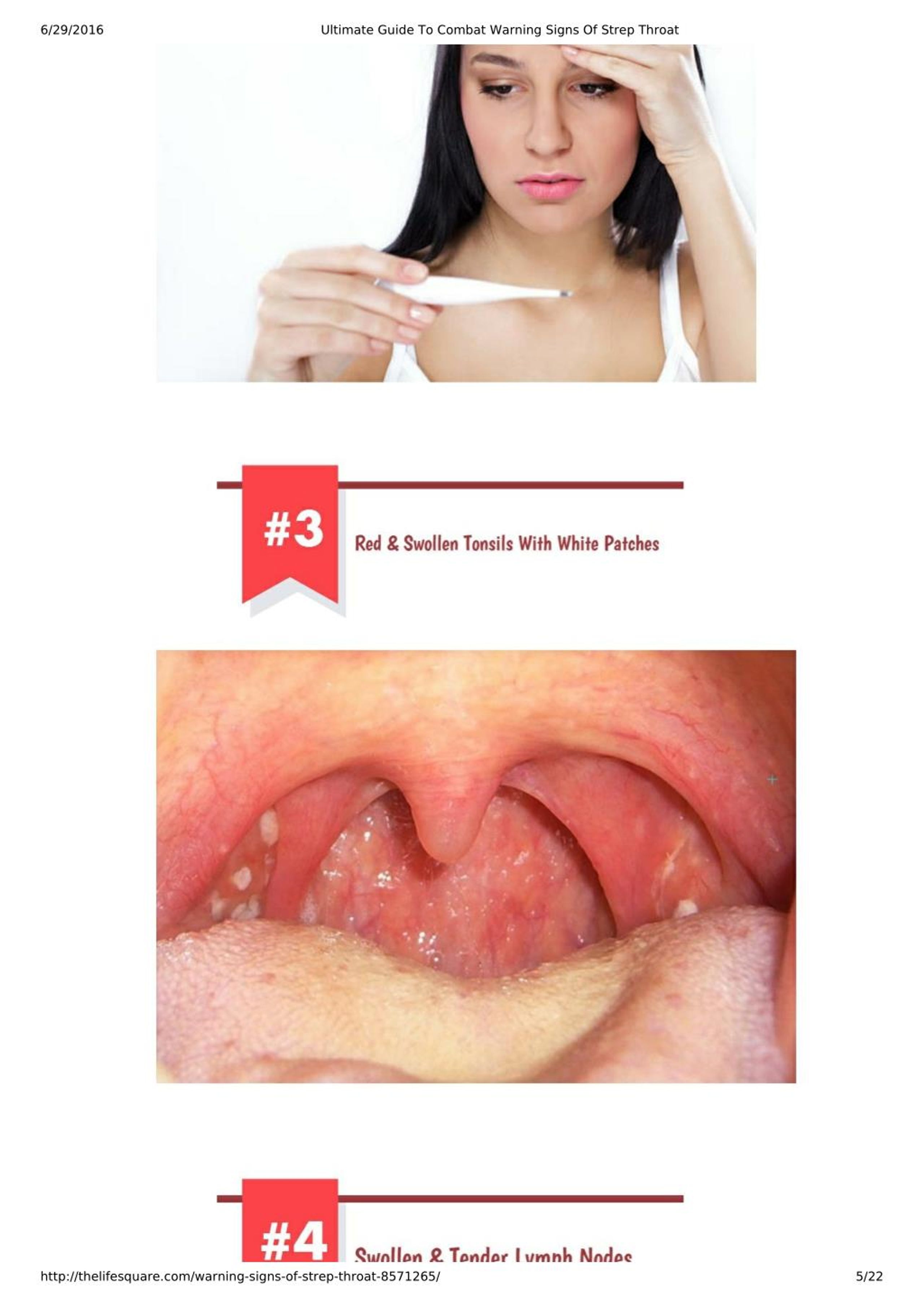 PPT Ultimate Guide To Combat Warning Signs Of Strep Throat PowerPoint