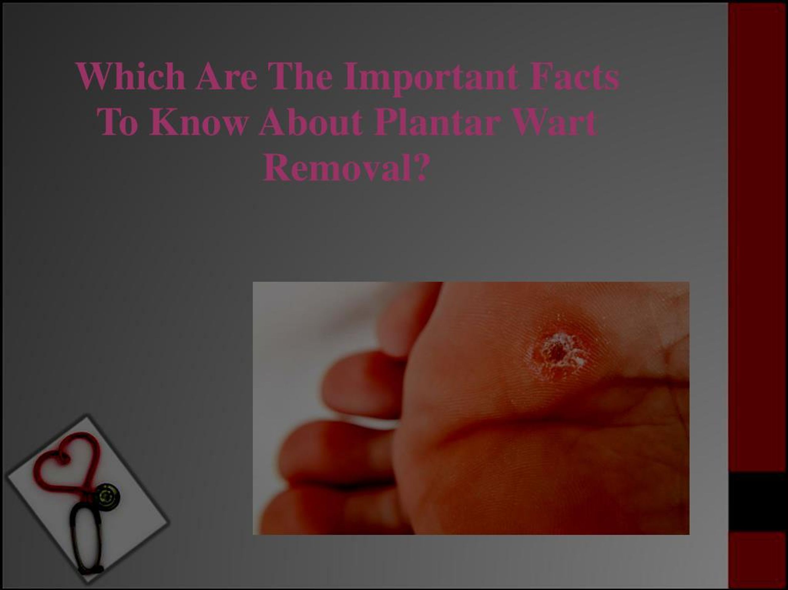 Ppt Which Are The Important Facts To Know About Plantar Wart