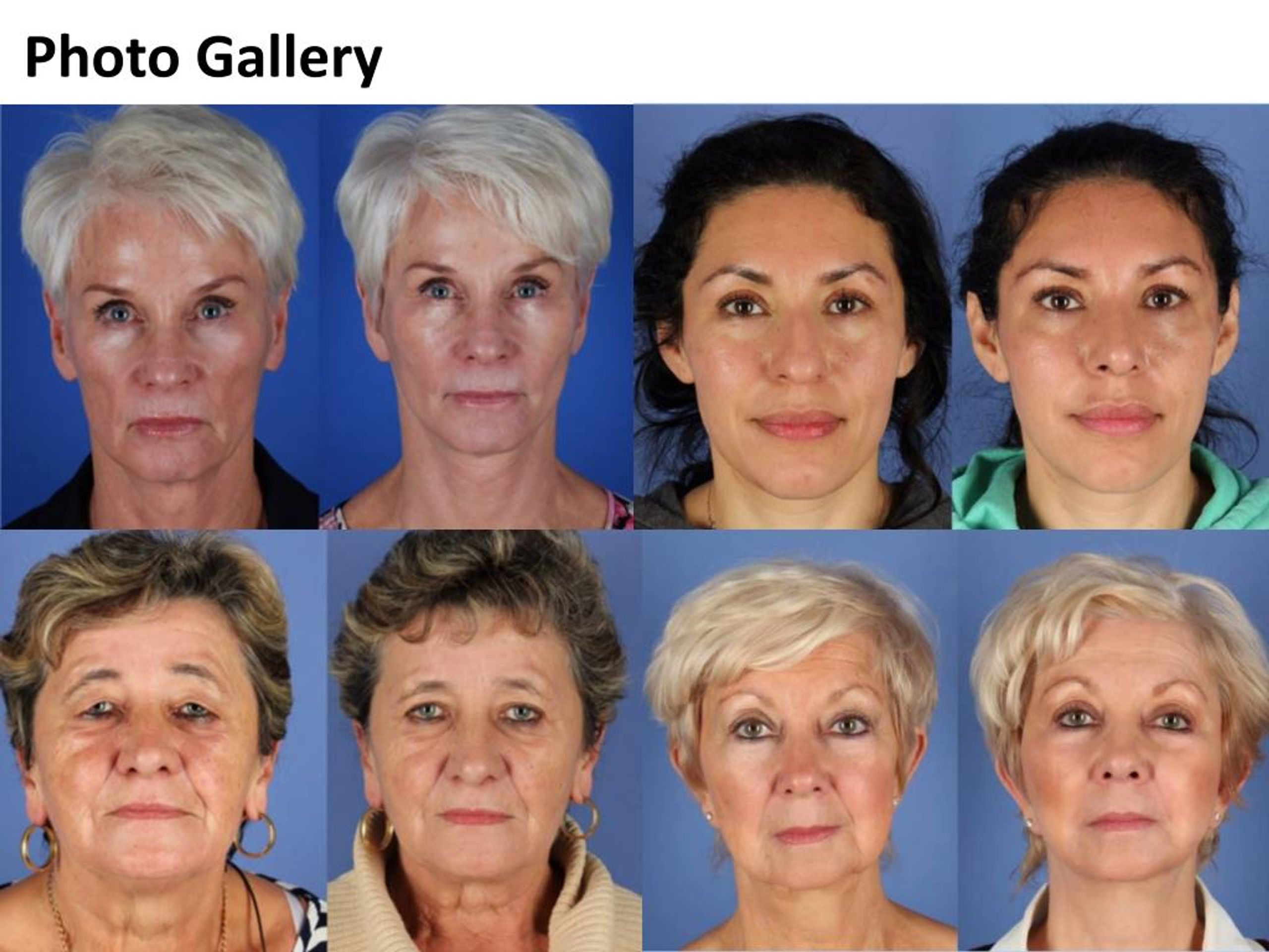 PPT Treating Common Aging Signs On Your Face PowerPoint Presentation