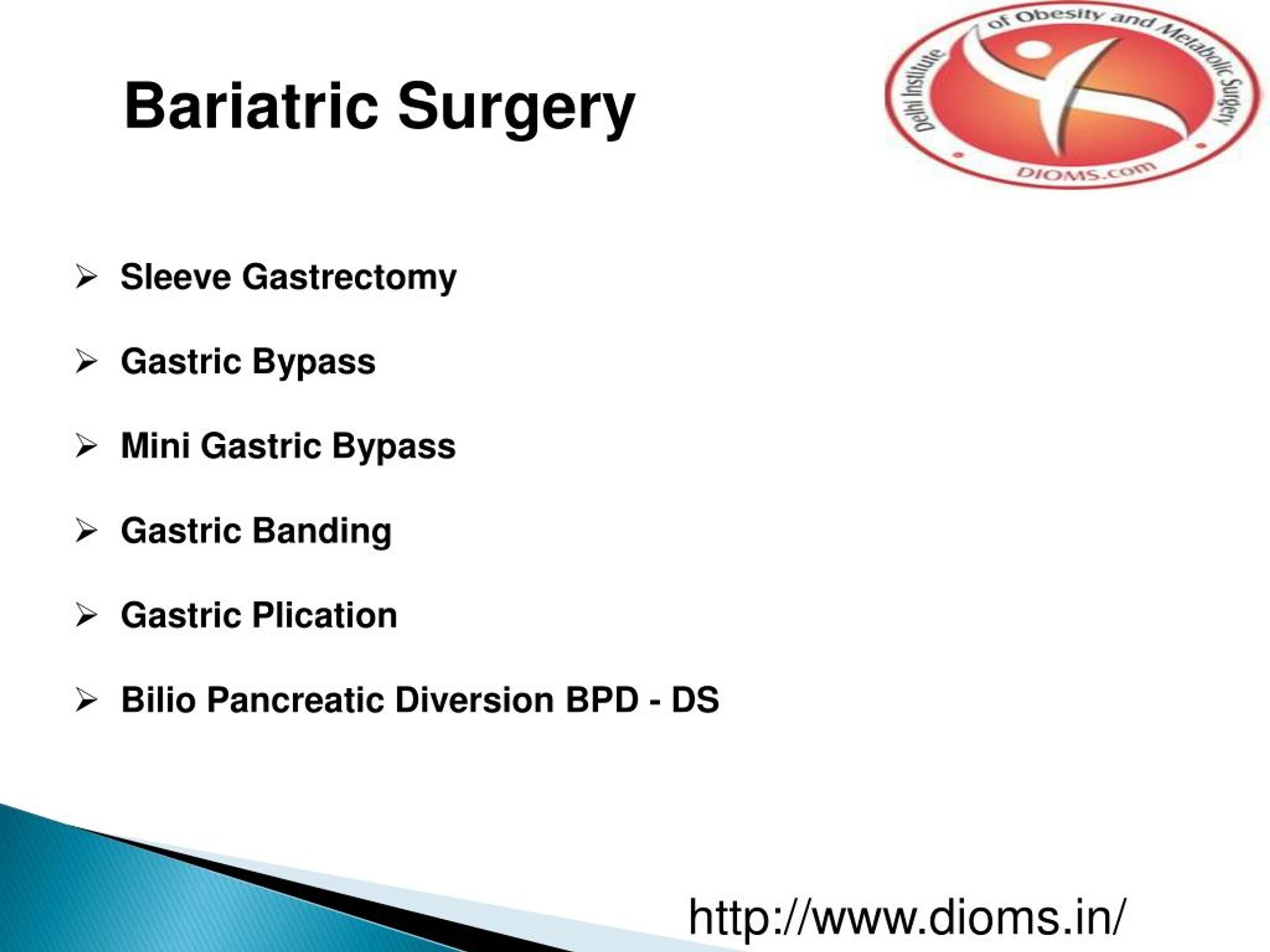 PPT Bariatric surgery Delhi PowerPoint Presentation, free download