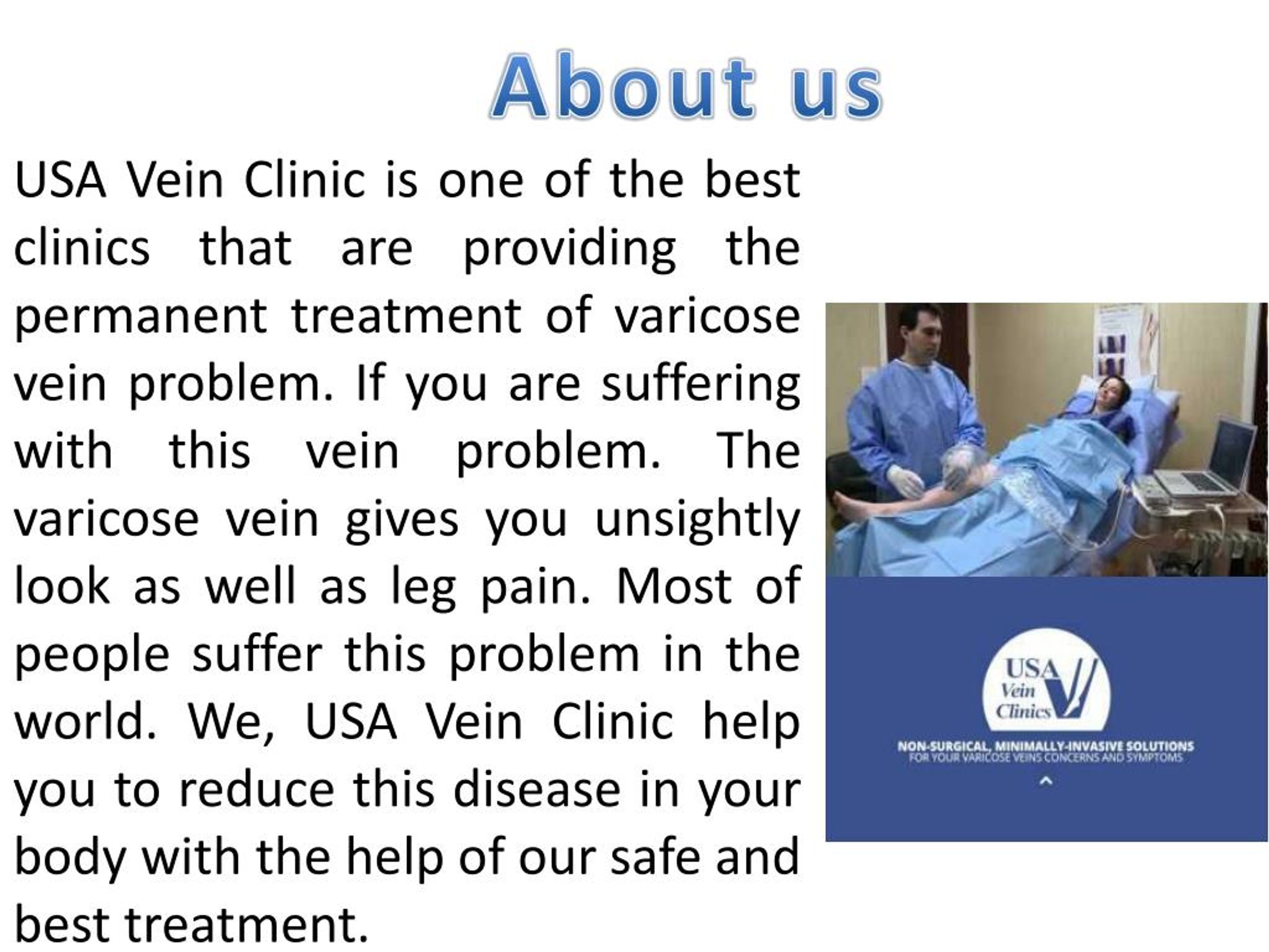 PPT varicose vein removal cost PowerPoint Presentation, free download