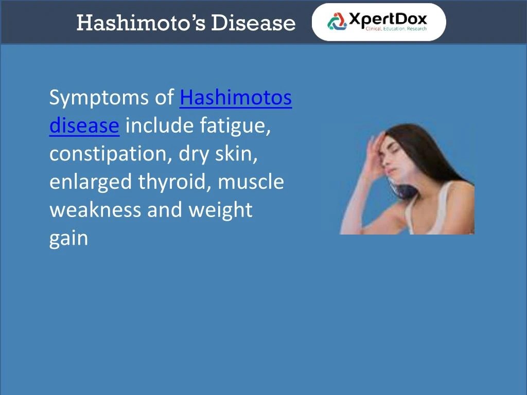 PPT Hashimotos disease PowerPoint Presentation ID7396295