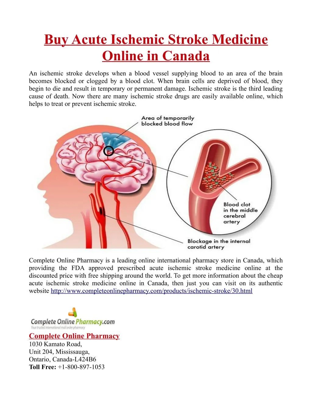 PPT Buy Acute Ischemic Stroke Medicine Online in Canada PowerPoint