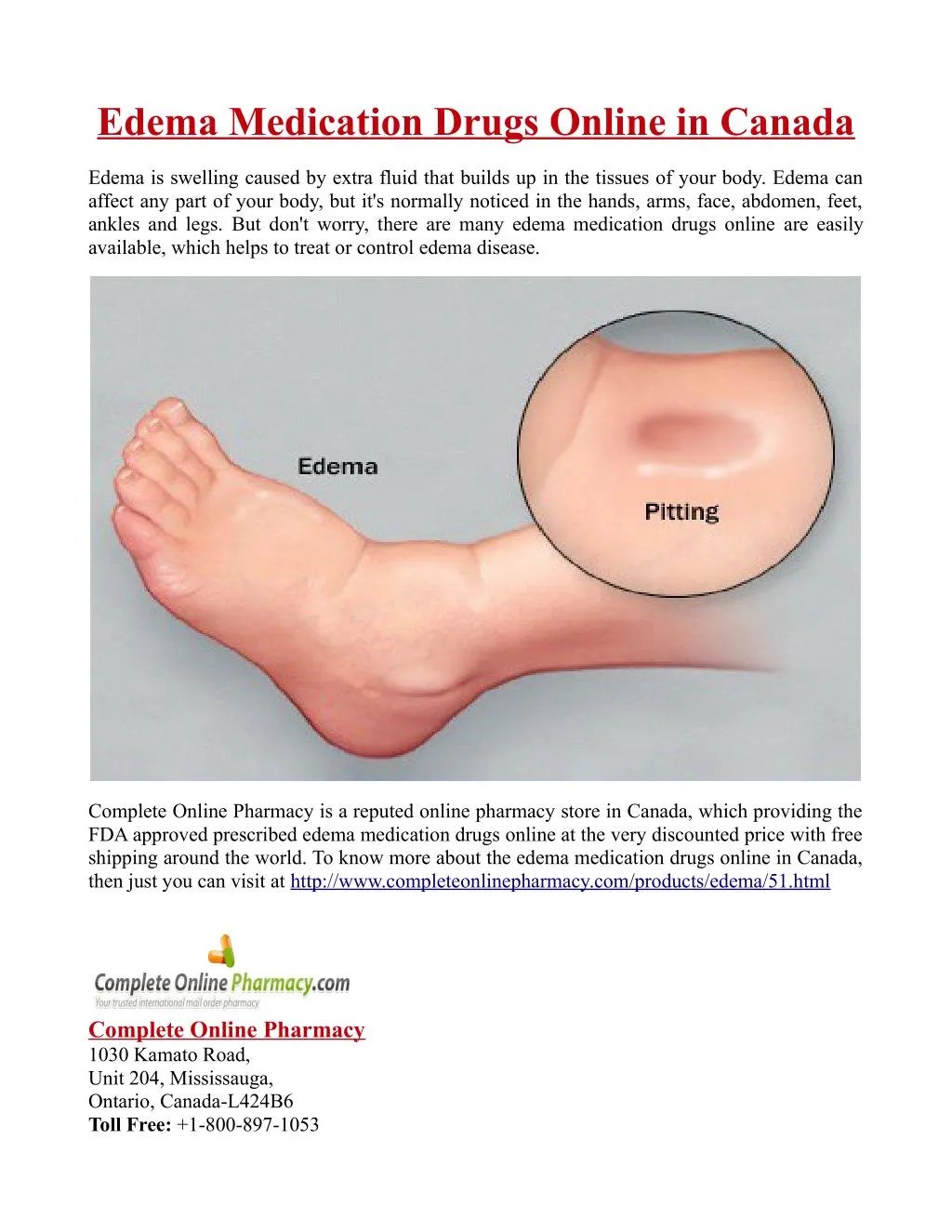 PPT Edema Medication Drugs Online in Canada PowerPoint Presentation