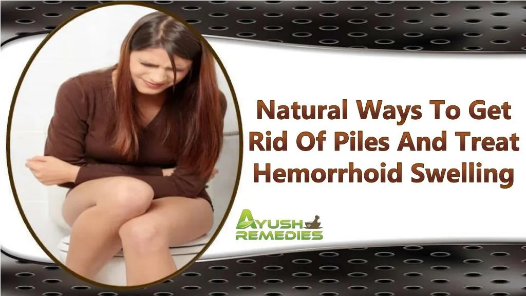 PPT Natural Ways To Get Rid Of Piles And Treat Hemorrhoid Swelling