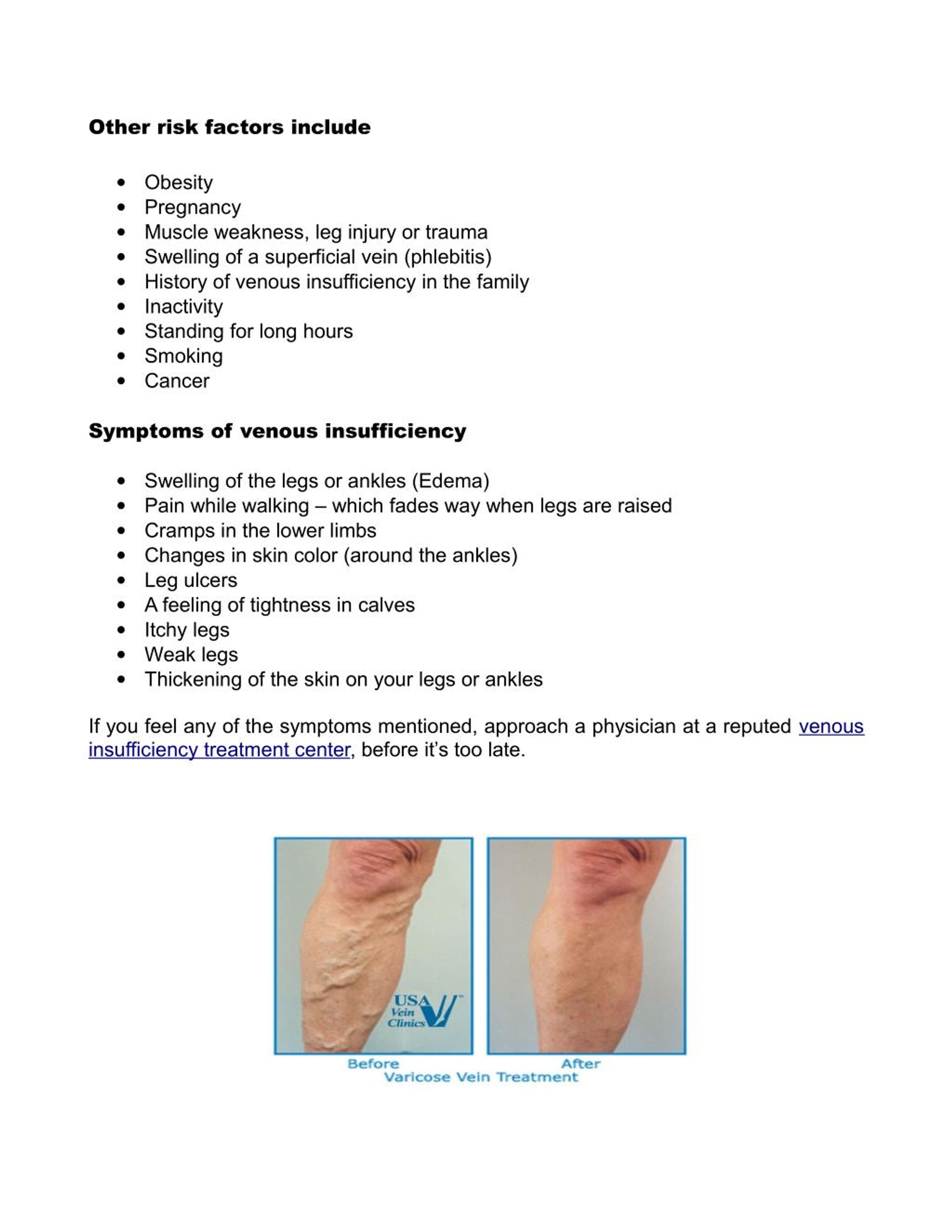 PPT Insight into Venous Insufficiency USA Vein Clinics PowerPoint
