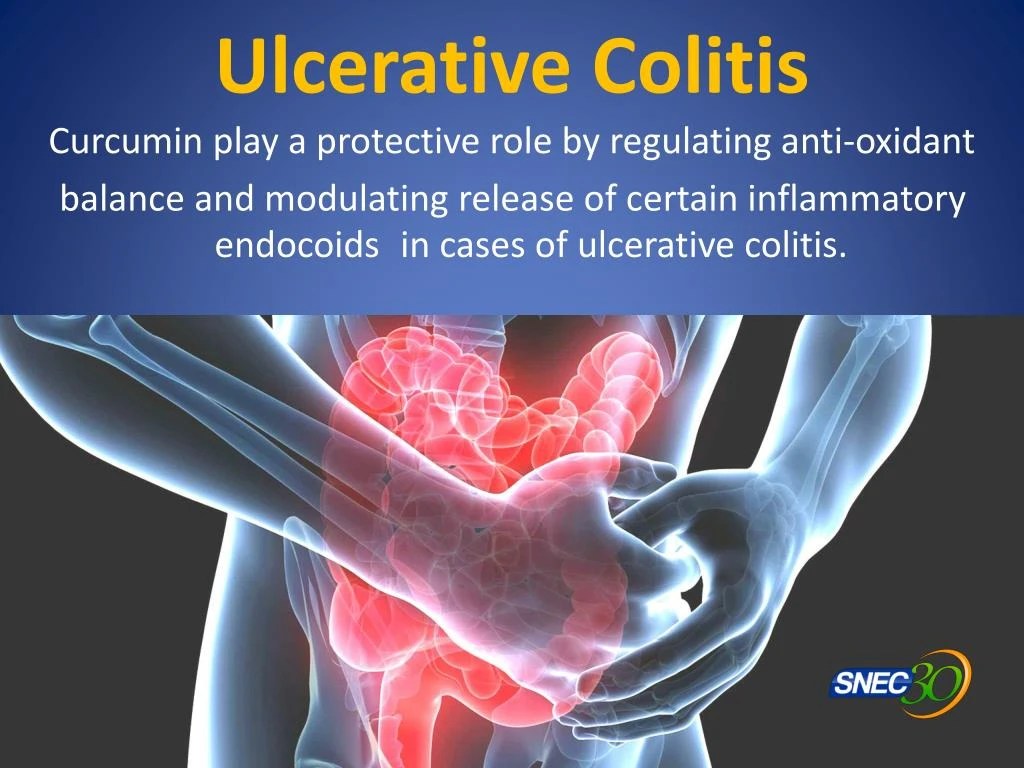 PPT Health Benefits of Turmeric PowerPoint Presentation ID7453982