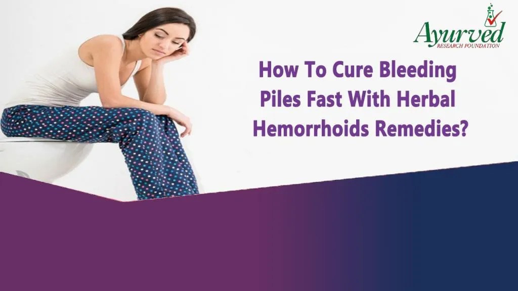 PPT How To Cure Bleeding Piles Fast With Herbal Hemorrhoids Remedies