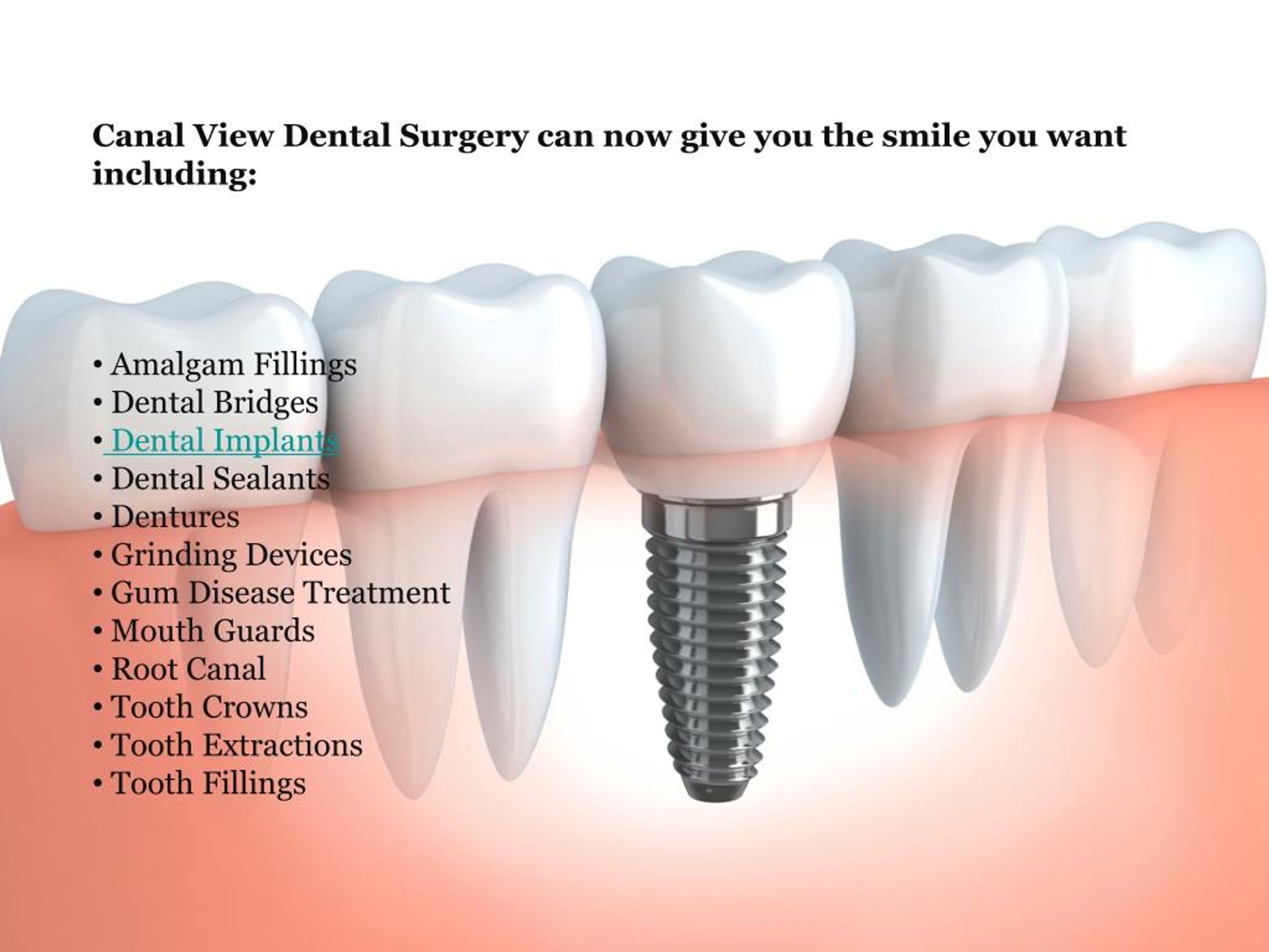 PPT Dental Teeth Implants and Root Canal Dentists in Dublin