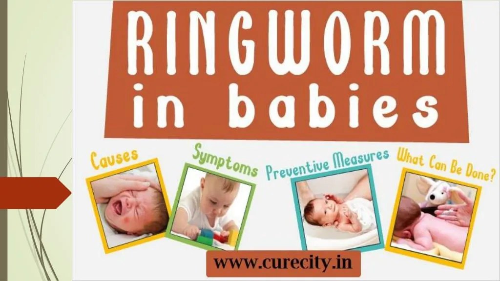 PPT How to treat ringworm in babies Curecity PowerPoint