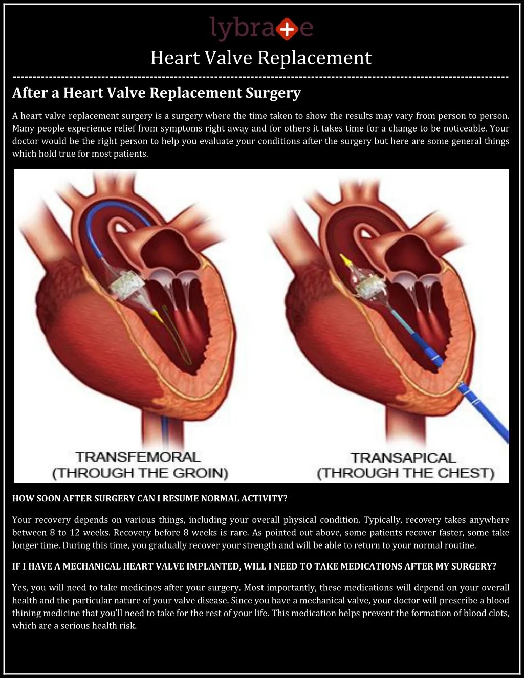 PPT Heart Valve Replacement Lybrate PowerPoint Presentation, free