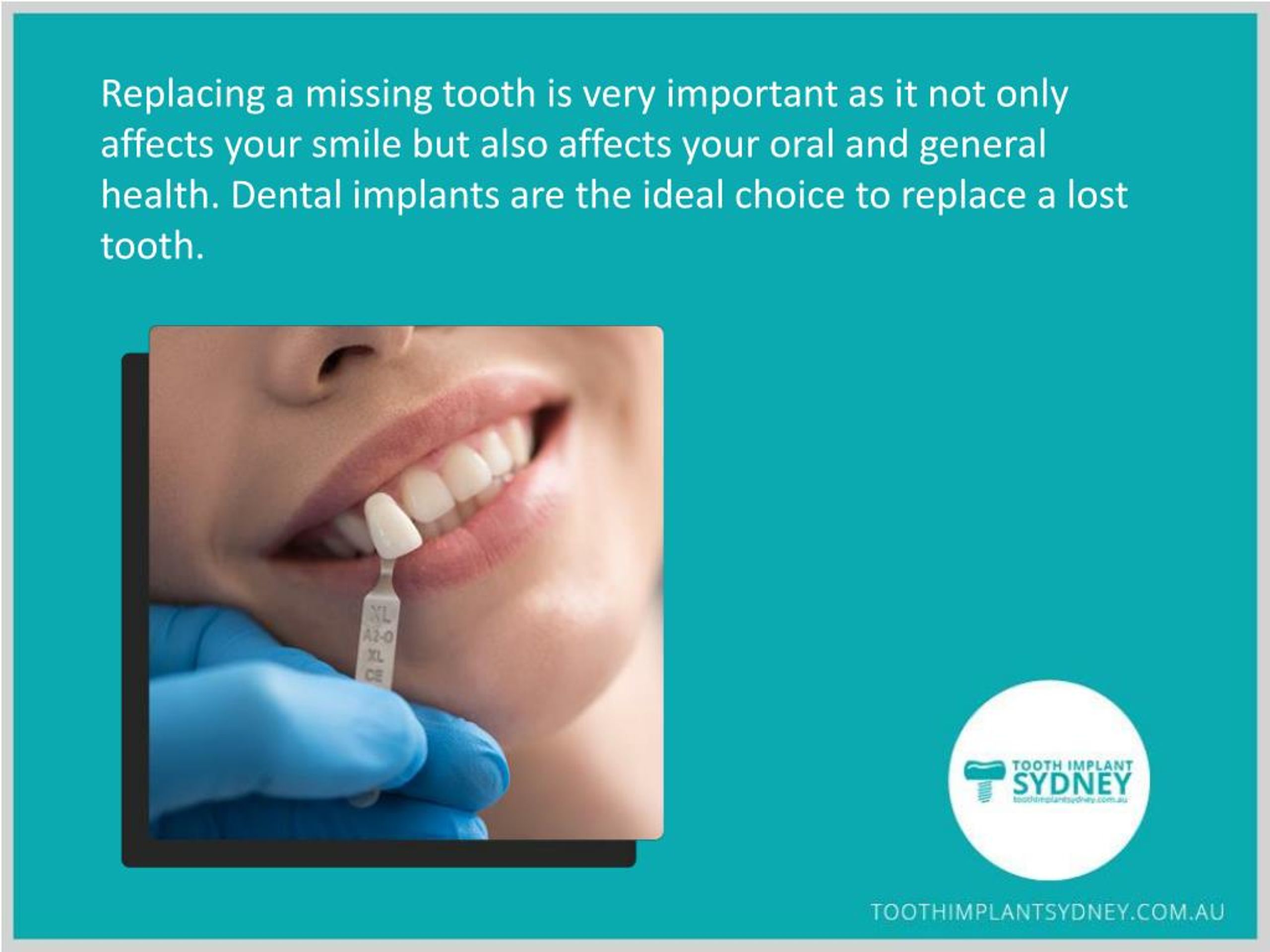 PPT Lost a Tooth? No worries, Replace It with Dental Implants