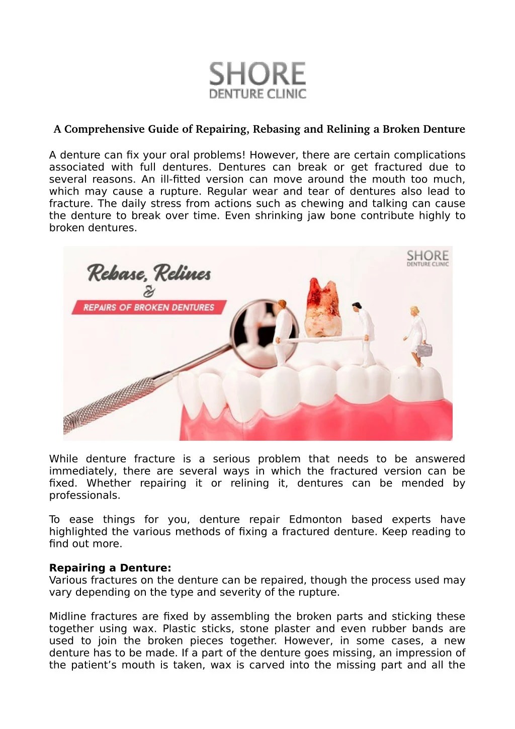 PPT A Comprehensive Guide of Repairing, Rebasing and Relining a