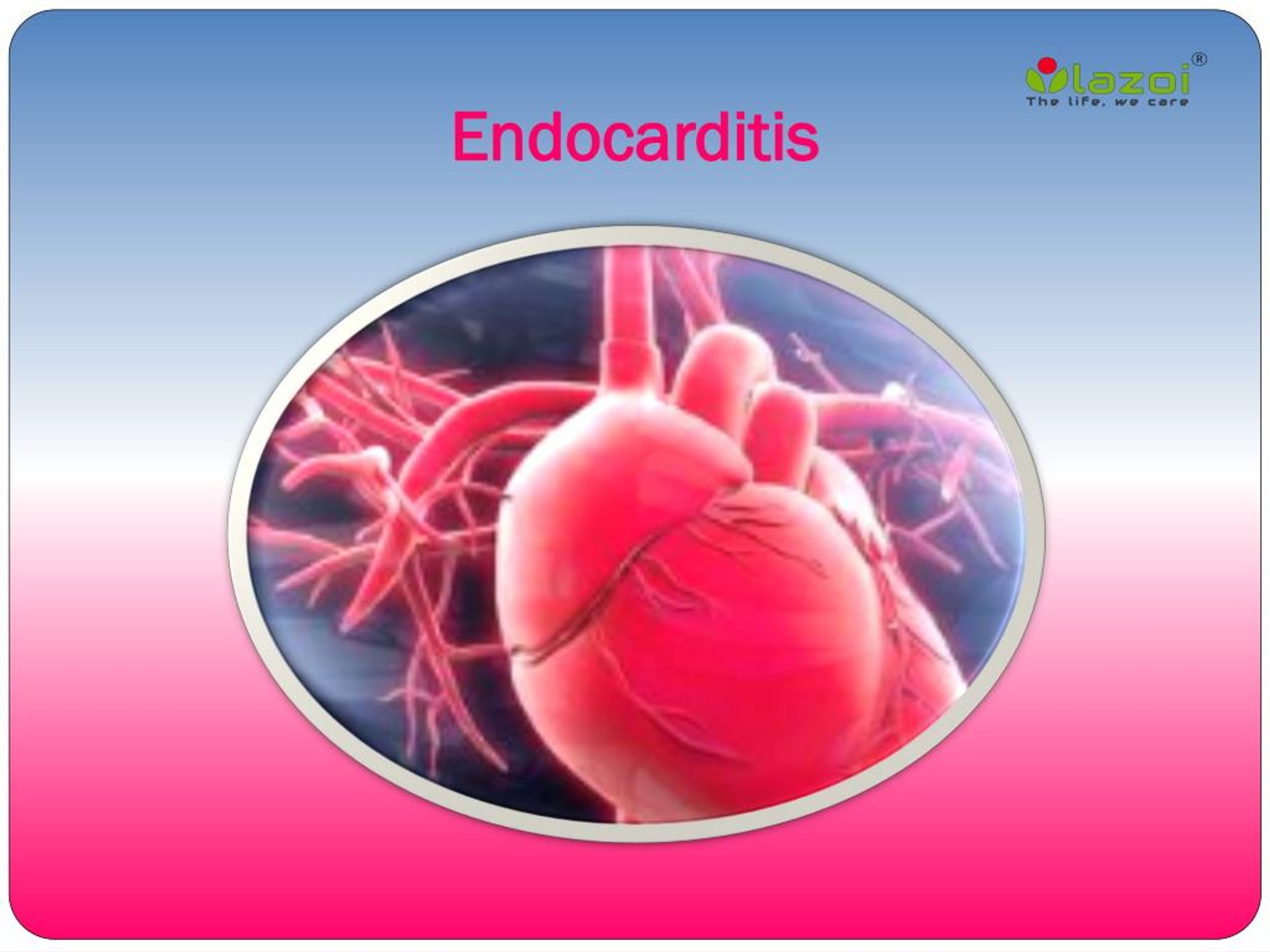 PPT Endocarditis PowerPoint Presentation, free download ID7947470