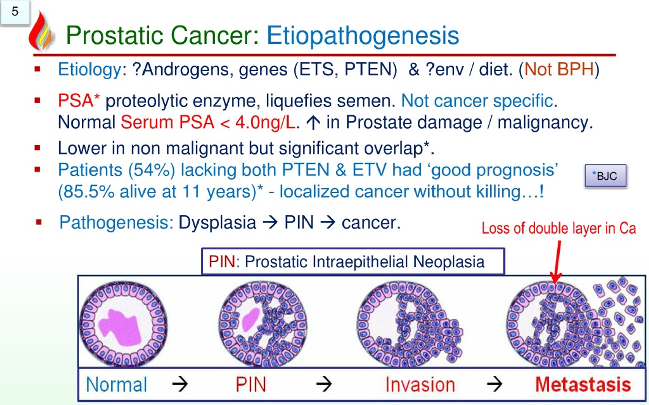 PPT Pathology of Prostate Cancer PowerPoint Presentation, free