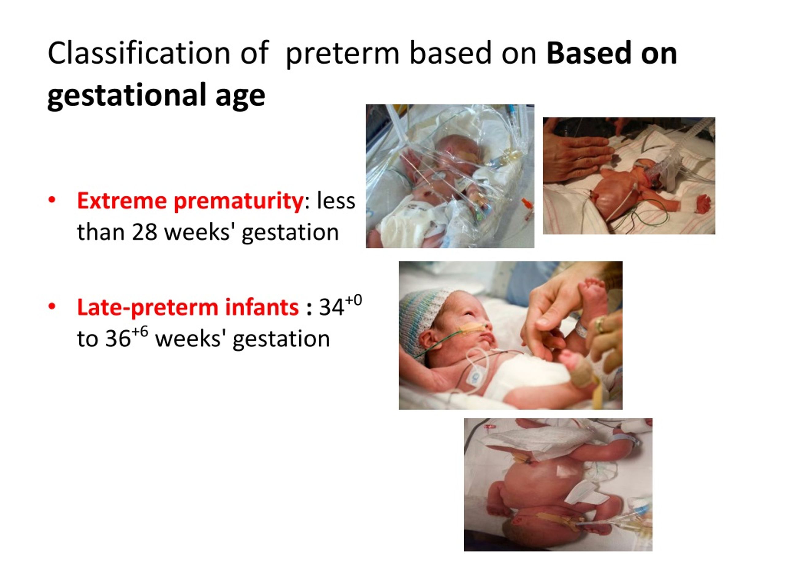 PPT Preterm Baby PowerPoint Presentation, free download ID9166874