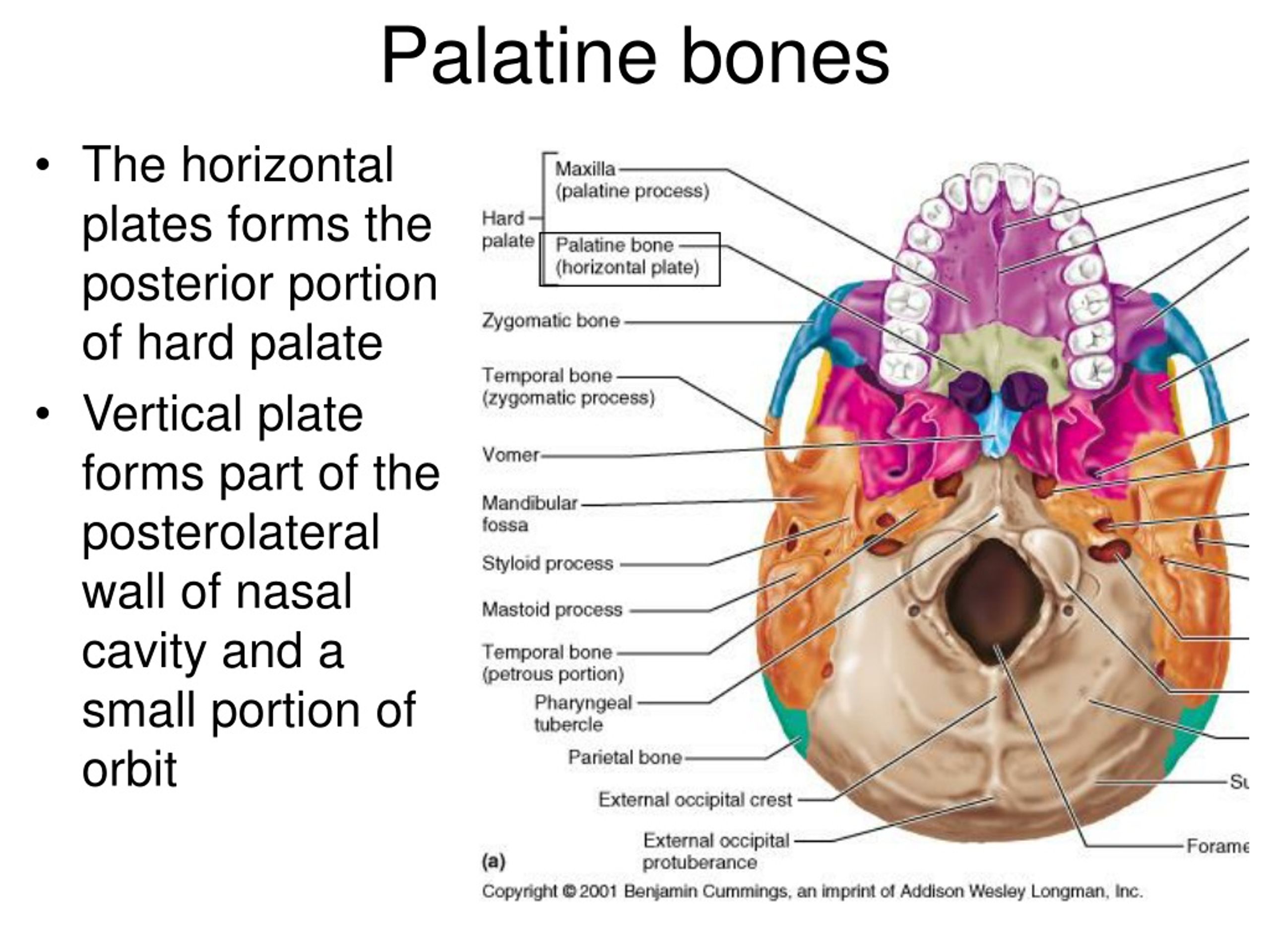 PPT Bones and structures of the neurocranium PowerPoint Presentation