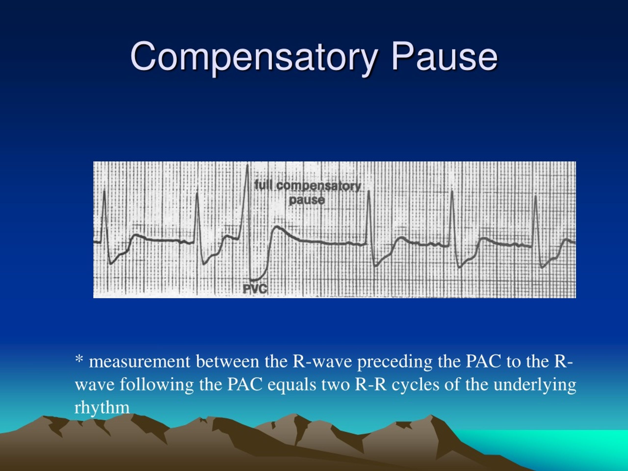 PPT Heart Rate and Arrhythmia Basics PowerPoint Presentation, free