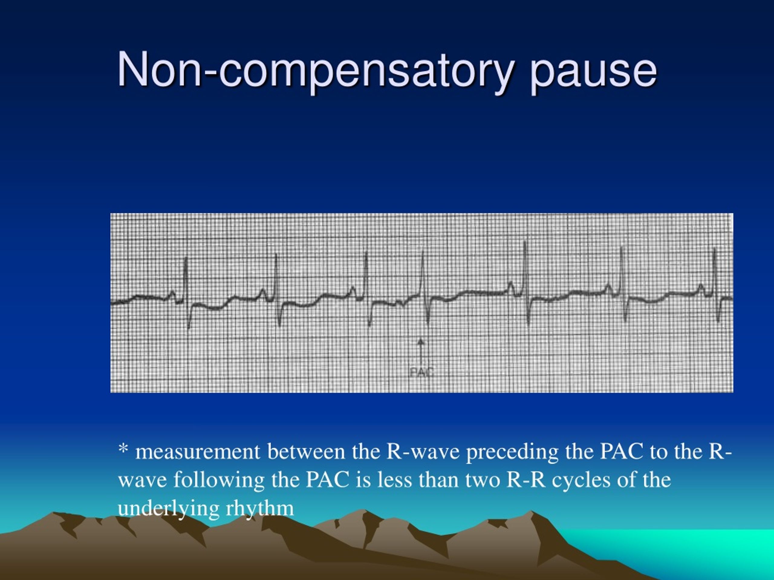 PPT Heart Rate and Arrhythmia Basics PowerPoint Presentation, free