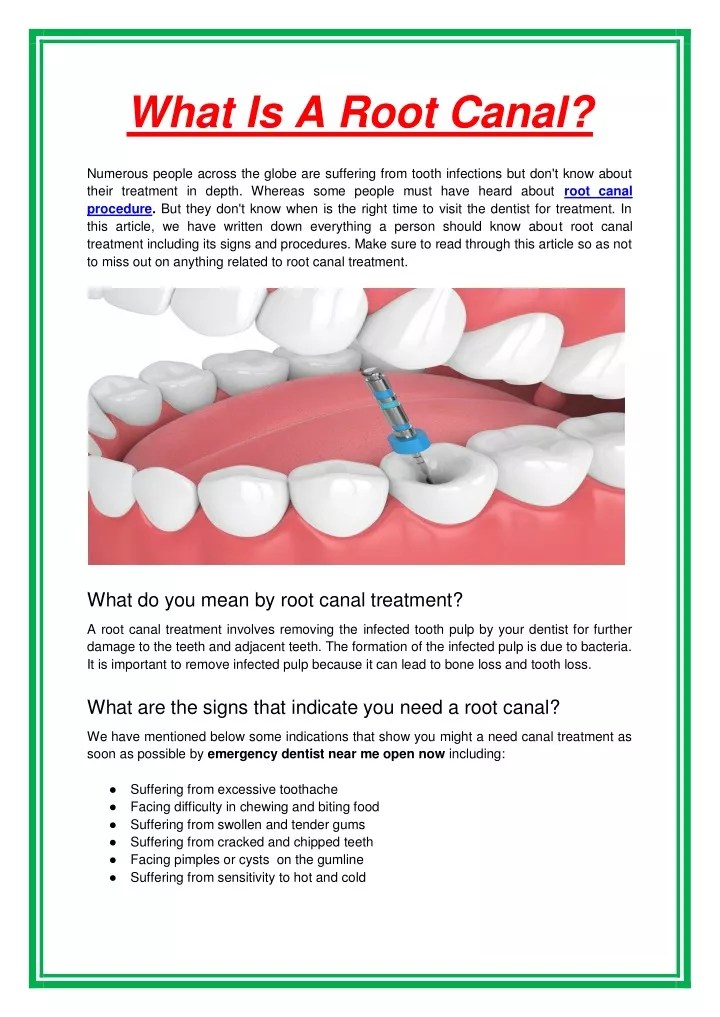 PPT What Is A Root Canal PowerPoint Presentation, free download ID