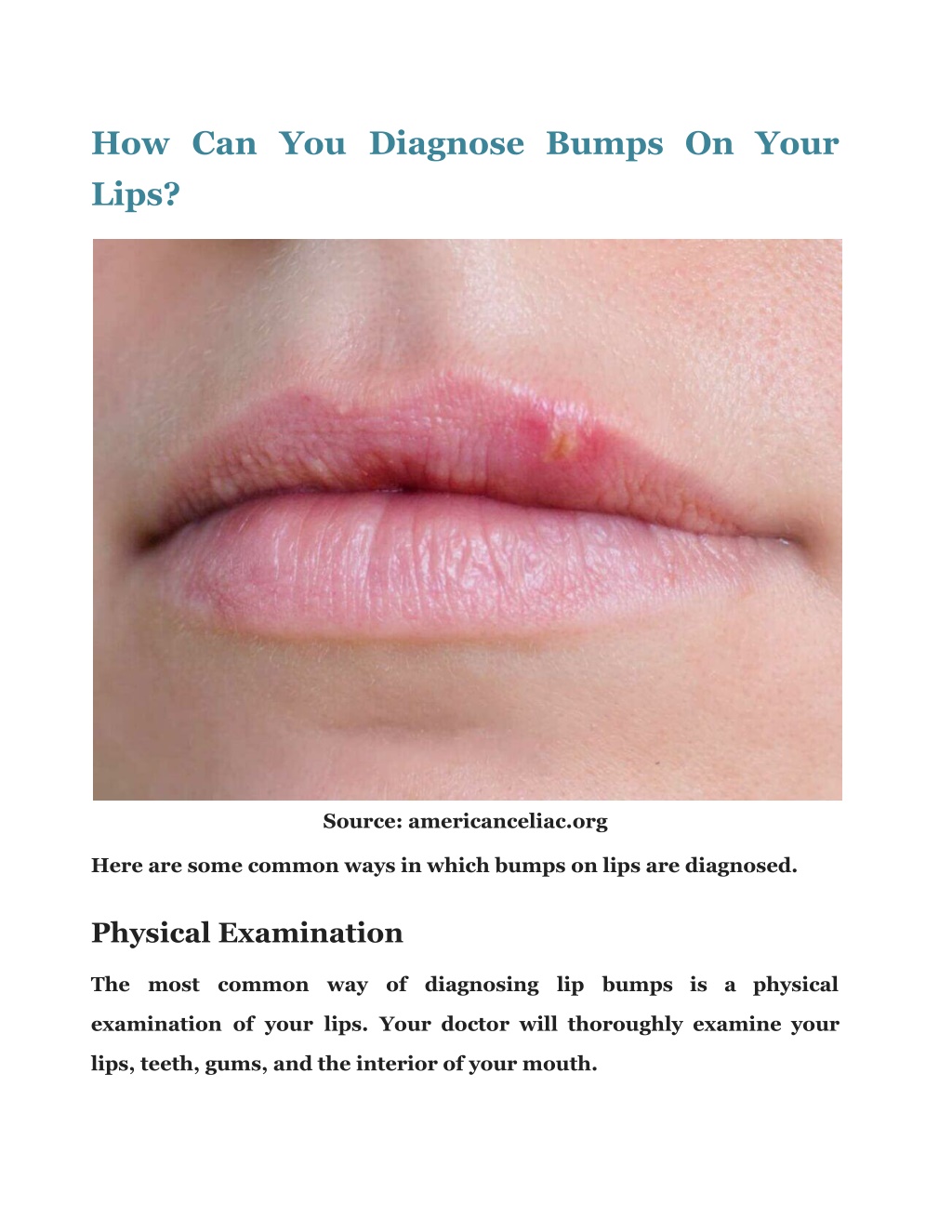 PPT Bump On Lip Check Out The Causes And Its Treatment PowerPoint