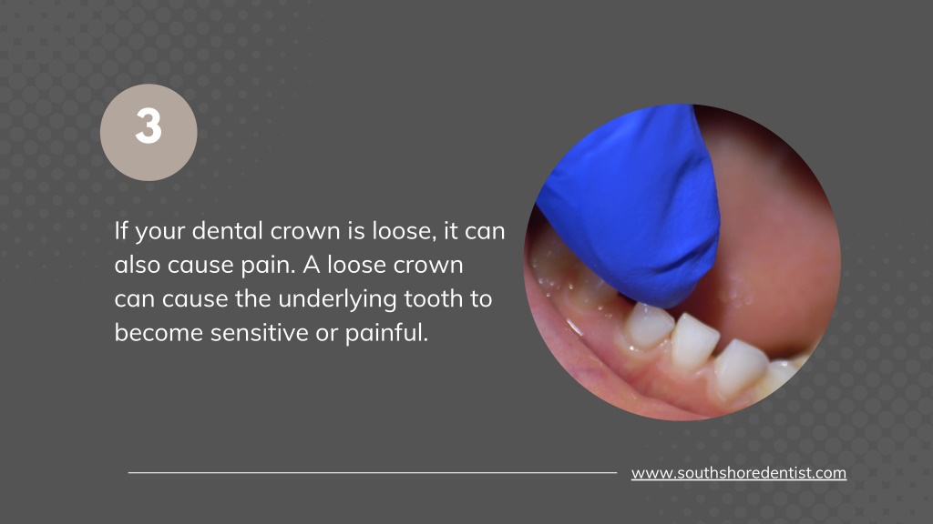 PPT Causes a dental Crown Might Hurt PowerPoint Presentation, free