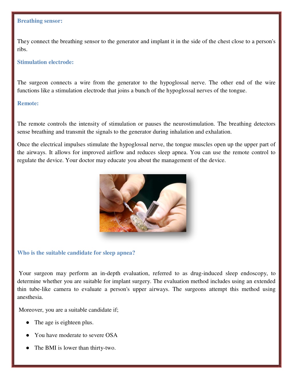 PPT How Does A Sleep Apnea Implant Work? PowerPoint Presentation