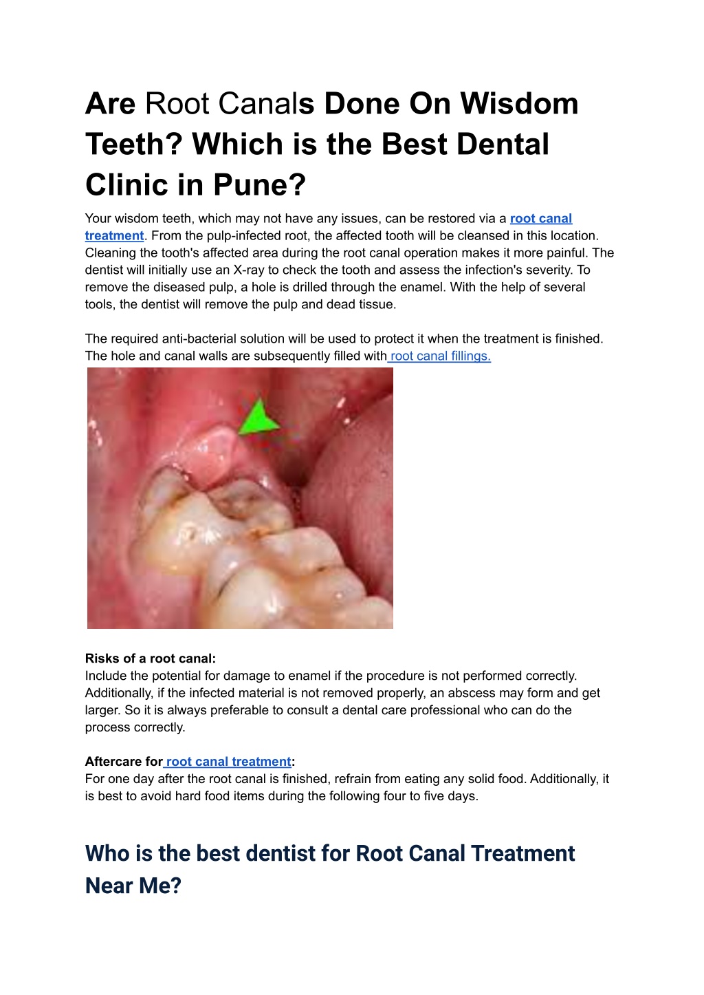 PPT Are Root Canals Done On Wisdom Teeth PowerPoint Presentation