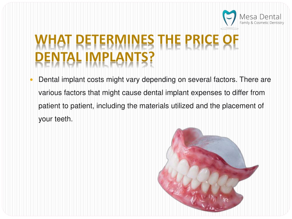 PPT Dental Implant Prices May Vary Depending On Several Factors