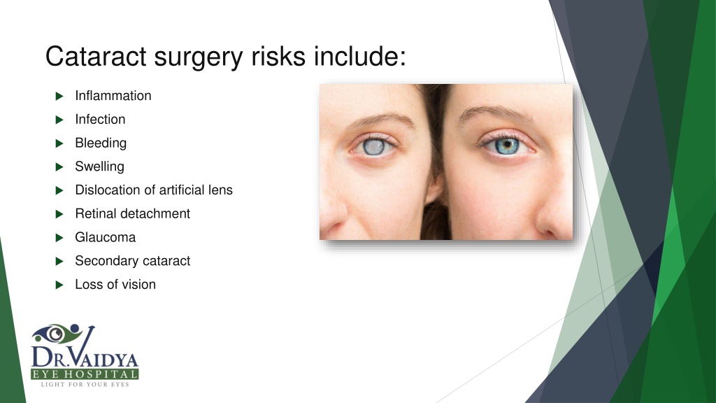 PPT Cataract Surgery_Dr. Vaidya Eye Hospital PowerPoint Presentation ID11823350