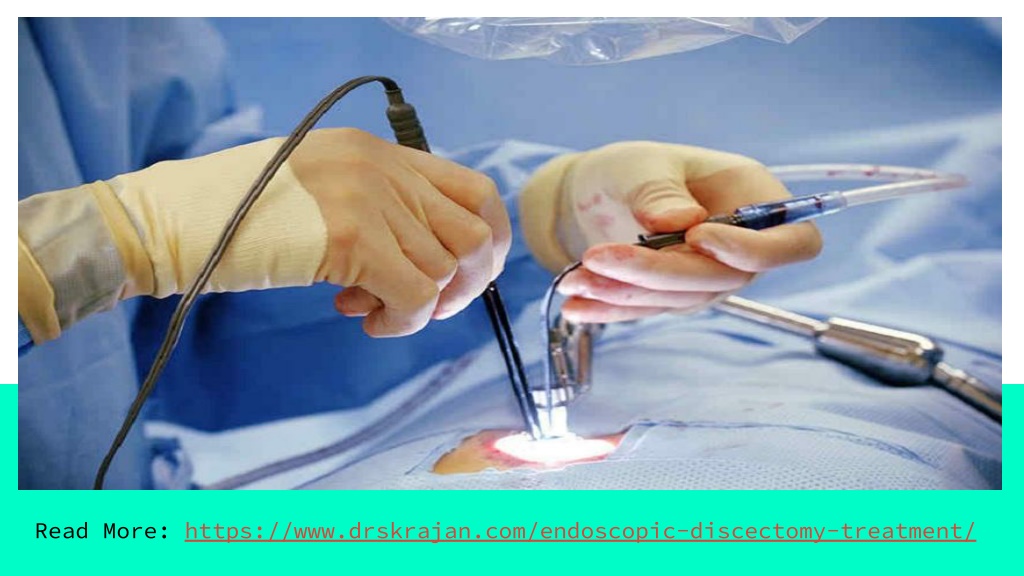 PPT Endoscopic Discectomy Surgeon in Gurgaon PowerPoint Presentation