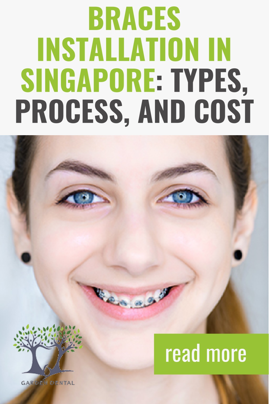 PPT Braces Installation in Singapore Types, Process, and Cost