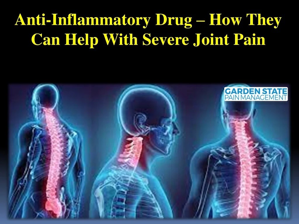 PPT AntiInflammatory Drug How They Can Help With Severe Joint Pain
