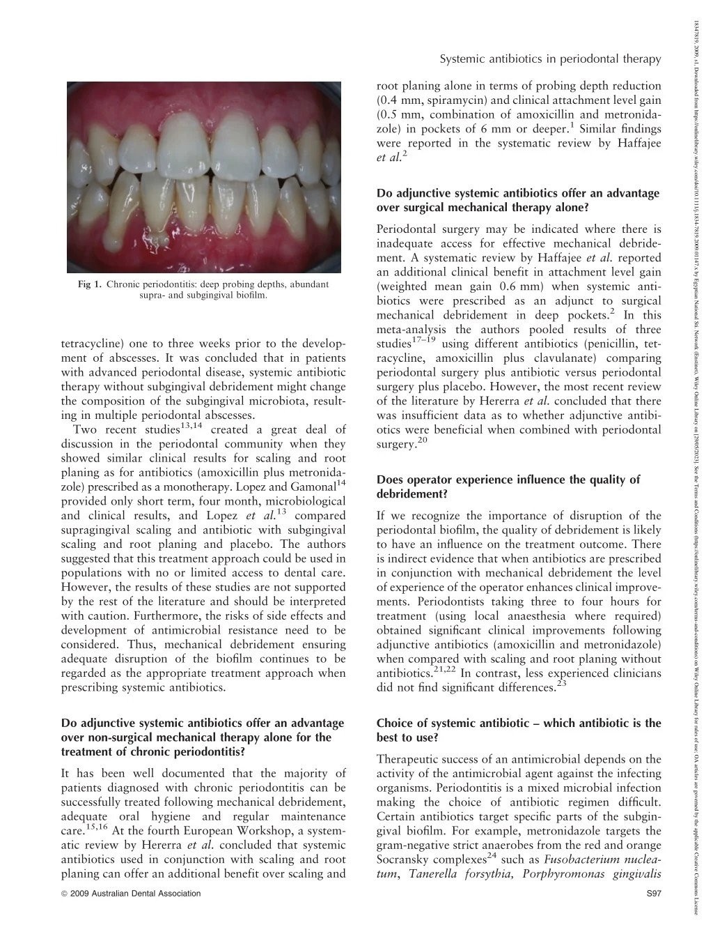 PPT Systemic antibiotics in periodontal therapyامراض اللثة د حاتم