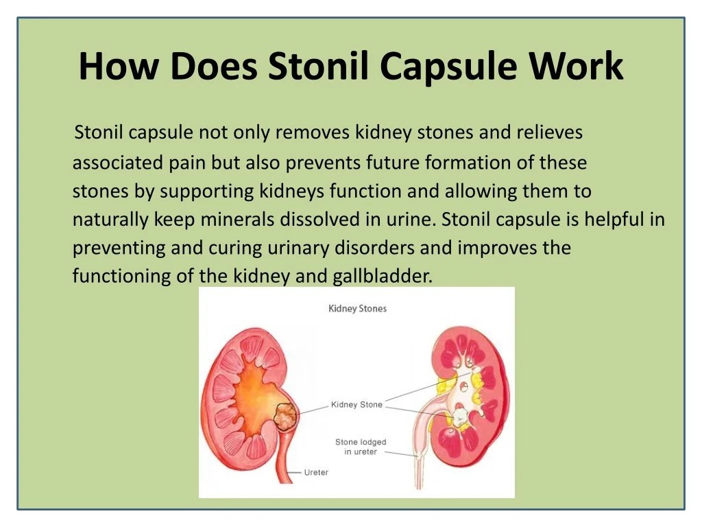 PPT Dissolve Kidney Stone with Stonil Capsule PowerPoint Presentation