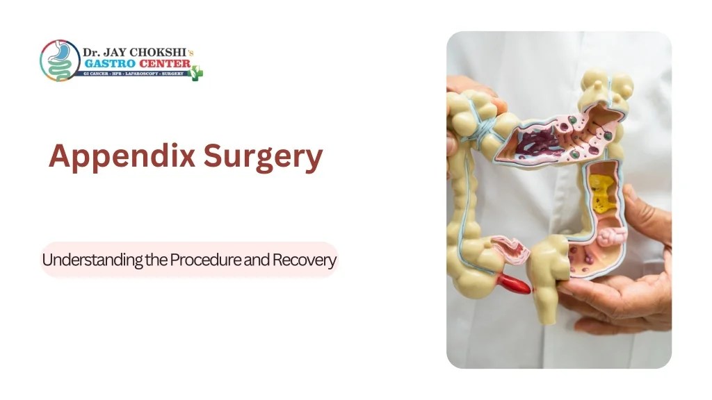 PPT Information about Appendix Surgery PowerPoint Presentation, free